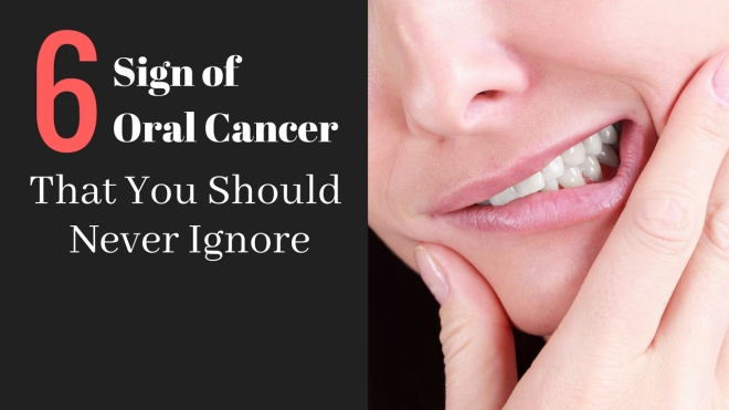 6 Sign of Oral Cancer That You Should Never Ignore